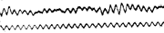 1st-eeg