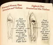 Siegbarste bones