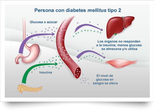 Eliminar diabetes tipo 2