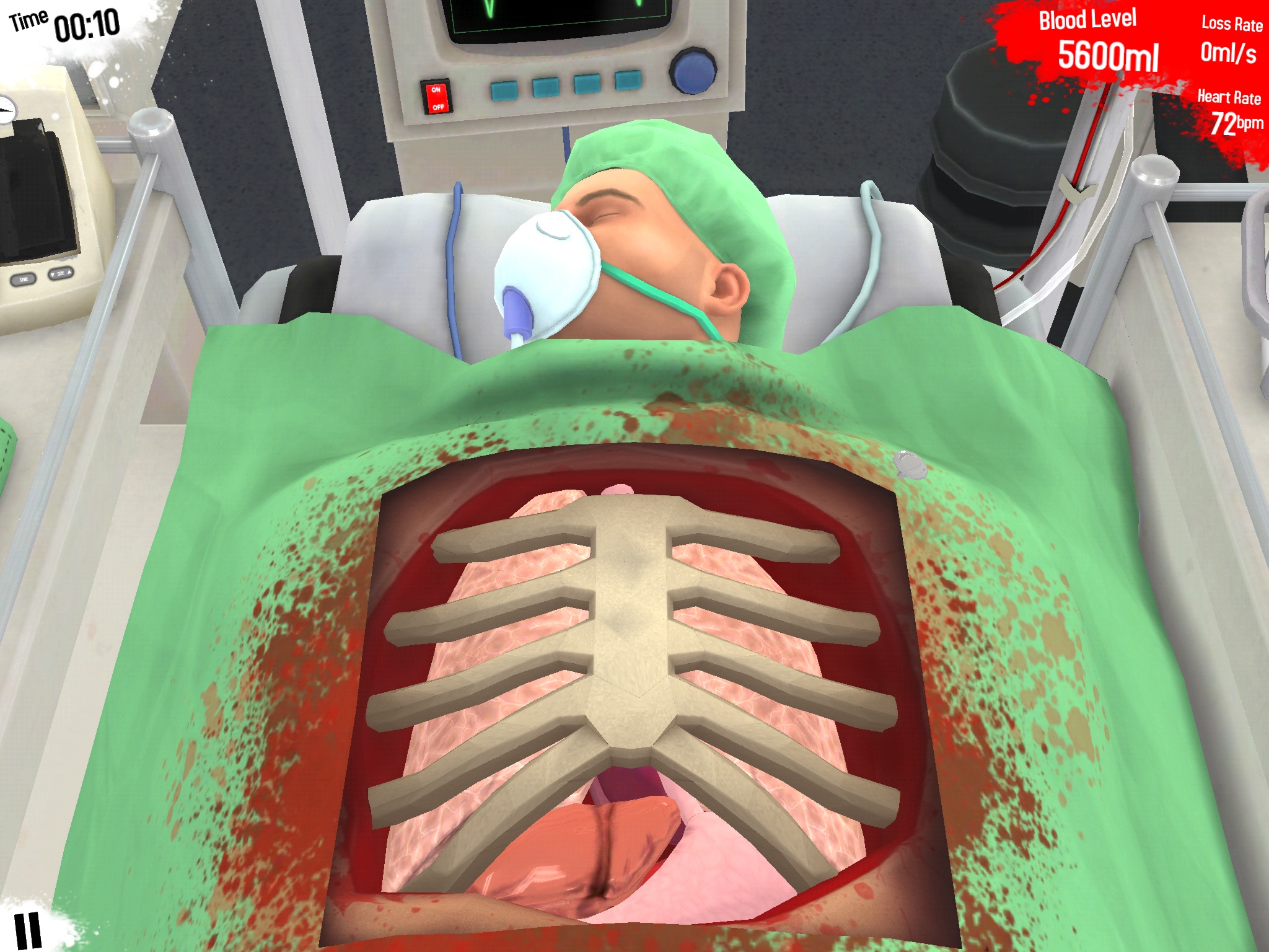 Surgeon simulator steam fix фото 108